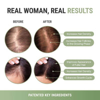 GrowMe | Daily Hair Support