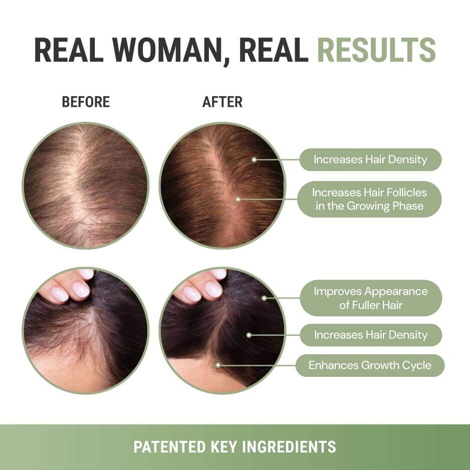 GrowMe Daily Hair Support