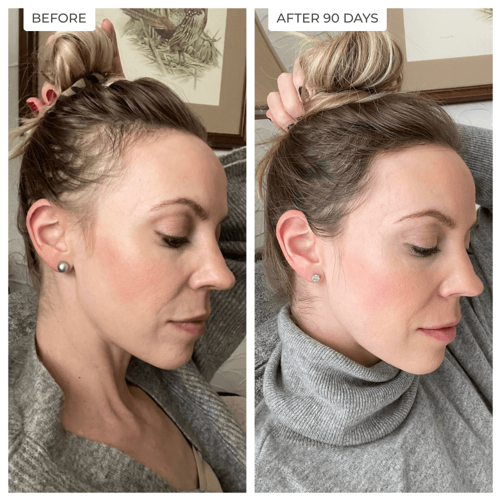 GrowMe Daily Hair Support